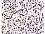 NRAS Antibody in Immunohistochemistry (Paraffin) (IHC (P))