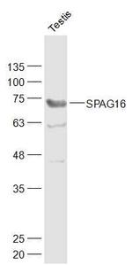 SPAG16 Antibody in Western Blot (WB)