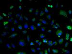 Cyclin D2 Antibody in Immunocytochemistry (ICC/IF)
