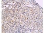 Cyclin D2 Antibody in Immunohistochemistry (Paraffin) (IHC (P))