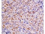 Cyclin D2 Antibody in Immunohistochemistry (Paraffin) (IHC (P))