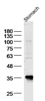 BBS8/TTC8 Antibody in Western Blot (WB)