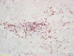 FOXD3 Antibody in Immunohistochemistry (Paraffin) (IHC (P))