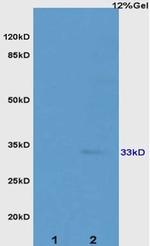 ATP1b2/Na+K+ATPase Antibody in Western Blot (WB)