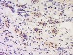 Calcipressin 1/DSCR 1 Antibody in Immunohistochemistry (Paraffin) (IHC (P))