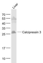 Calcipressin 3 Antibody in Western Blot (WB)