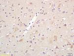 Centaurin alpha 1 Antibody in Immunohistochemistry (Paraffin) (IHC (P))