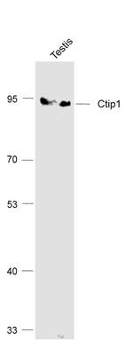 Ctip1/BCL-11A Antibody in Western Blot (WB)