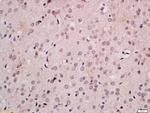 FOXB1 Antibody in Immunohistochemistry (Paraffin) (IHC (P))