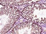 HOXC5 Antibody in Immunohistochemistry (Paraffin) (IHC (P))