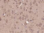Phospho-GluR1 (Ser863) Antibody in Immunohistochemistry (Paraffin) (IHC (P))