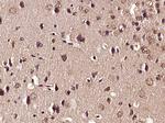 Phospho-GluR1 (Ser863) Antibody in Immunohistochemistry (Paraffin) (IHC (P))