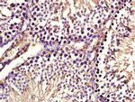 Aph-1b Antibody in Immunohistochemistry (Paraffin) (IHC (P))