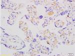 ADFP Antibody in Immunohistochemistry (Paraffin) (IHC (P))