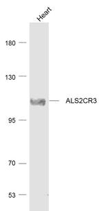 ALS2CR3 Antibody in Western Blot (WB)