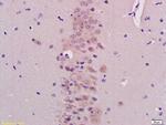 BHLHB9/p60TRP Antibody in Immunohistochemistry (Paraffin) (IHC (P))