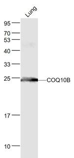 COQ10B Antibody in Western Blot (WB)