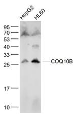 COQ10B Antibody in Western Blot (WB)
