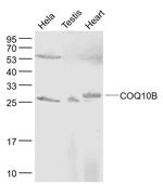 COQ10B Antibody in Western Blot (WB)