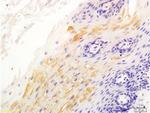 Beta catenin Antibody in Immunohistochemistry (Paraffin) (IHC (P))