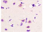 Beta catenin Antibody in Immunohistochemistry (Paraffin) (IHC (P))