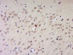 PNUTS/PPP1R10 Antibody in Immunohistochemistry (Paraffin) (IHC (P))
