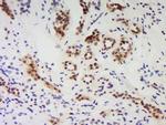 PNUTS/PPP1R10 Antibody in Immunohistochemistry (Paraffin) (IHC (P))