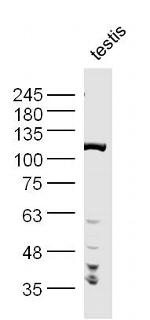 PNUTS/PPP1R10 Antibody in Western Blot (WB)