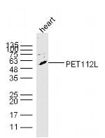 PET112L Antibody in Western Blot (WB)