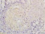 ROCK1 Antibody in Immunohistochemistry (Paraffin) (IHC (P))