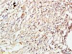 ROCK1 Antibody in Immunohistochemistry (Paraffin) (IHC (P))