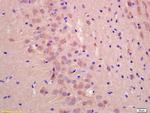 UBXD2 Antibody in Immunohistochemistry (Paraffin) (IHC (P))