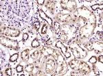 UBXD2 Antibody in Immunohistochemistry (Paraffin) (IHC (P))