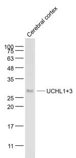 UCHL1+3 Antibody in Western Blot (WB)