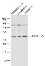 UCHL1+3 Antibody in Western Blot (WB)