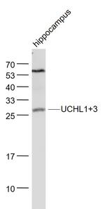 UCHL1+3 Antibody in Western Blot (WB)