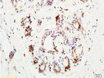 CCR3 Antibody in Immunohistochemistry (Paraffin) (IHC (P))