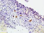 CCR3 Antibody in Immunohistochemistry (Paraffin) (IHC (P))