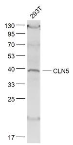 CLN5 Antibody in Western Blot (WB)