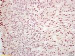 Capicua/CIC Antibody in Immunohistochemistry (Paraffin) (IHC (P))