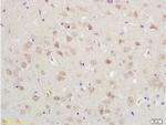 N-cadherin Antibody in Immunohistochemistry (Paraffin) (IHC (P))