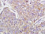 N-cadherin Antibody in Immunohistochemistry (Paraffin) (IHC (P))