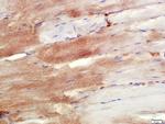 NDUFS7 Antibody in Immunohistochemistry (Paraffin) (IHC (P))