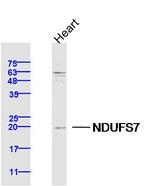 NDUFS7 Antibody in Western Blot (WB)