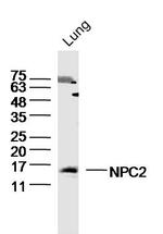 NPC2/Niemann Pick C2 Antibody in Western Blot (WB)