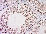 TFIID/TATA binding protein TBP Antibody in Immunohistochemistry (Paraffin) (IHC (P))