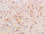 TMEM158 Antibody in Immunohistochemistry (Paraffin) (IHC (P))
