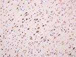 TMEM158 Antibody in Immunohistochemistry (Paraffin) (IHC (P))