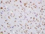 WRB/CHD5 Antibody in Immunohistochemistry (Paraffin) (IHC (P))