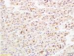IL-17 Antibody in Immunohistochemistry (Paraffin) (IHC (P))